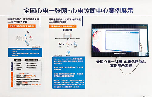 市卫生局—心电一张网 莱西模式全国推广 (1).jpg